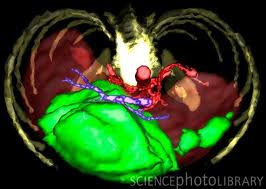 Magnetic Resonance Imaging
