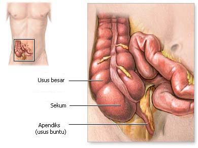kanker usus