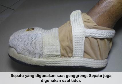 Sepatu untuk ganggreng